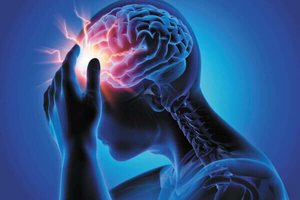 headache3 - Clinical Papers & Research