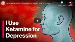  Image Name  - Learn More About Ketamine, Psychotherapy, and Combination Infusion Therapy
